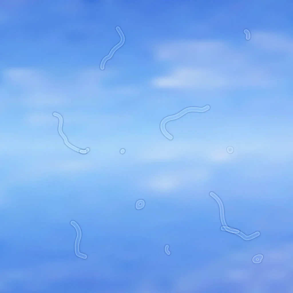 Eye ‘floaters’ are not usually a concern