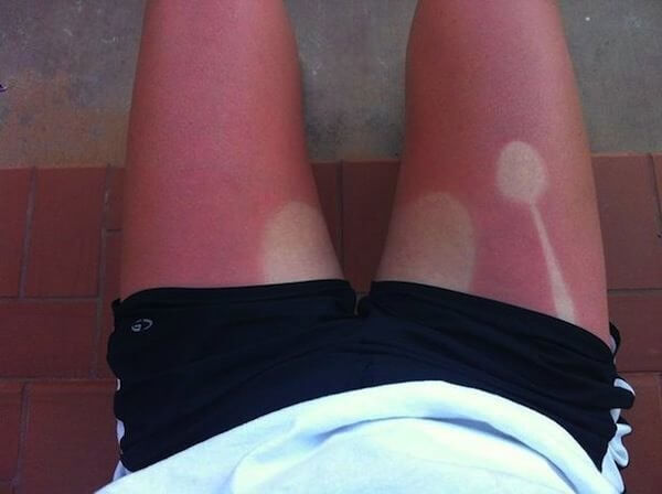 "Have Lunch Outside," They Said