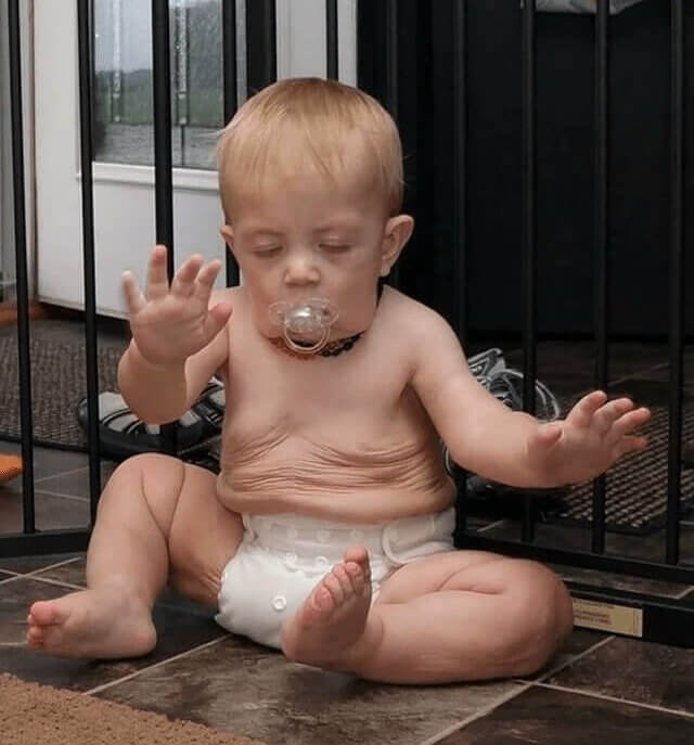 Could This Be The Real Benjamin Button?