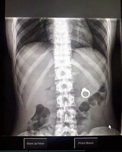 That's Not What You're Supposed to Put It on