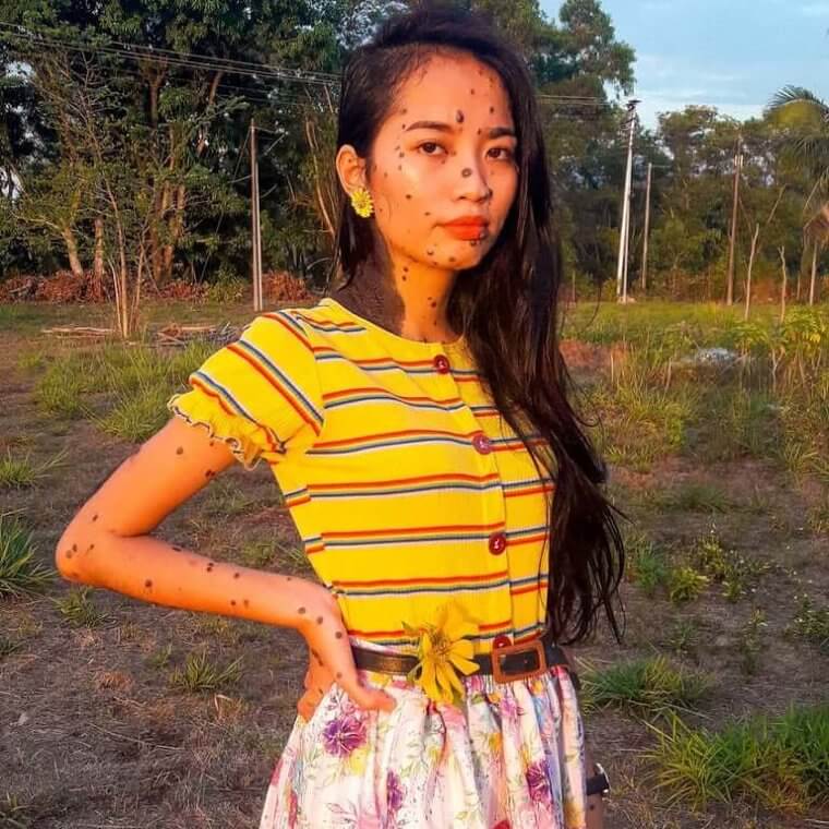 Evita Delmundo Has Embraced Her Beauty Marks